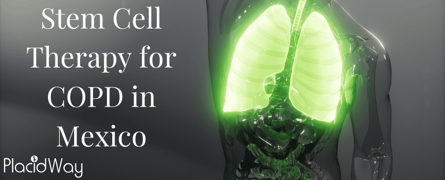 COPD Treatment through Stem Cells in Mexico thumbnail